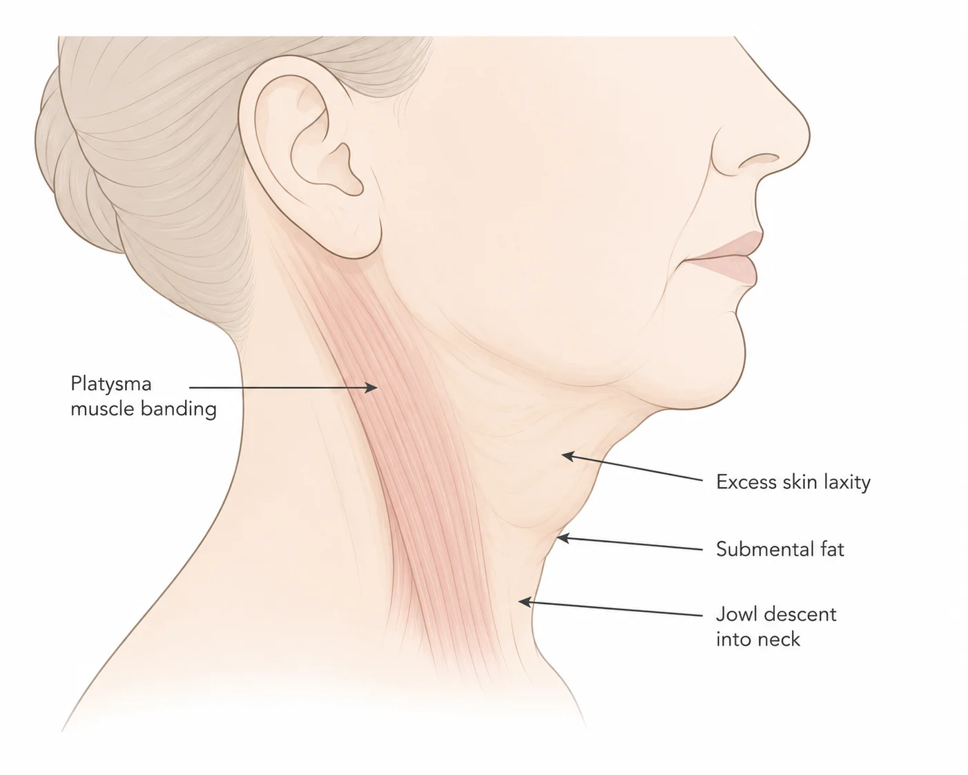 What Causes Neck Aging